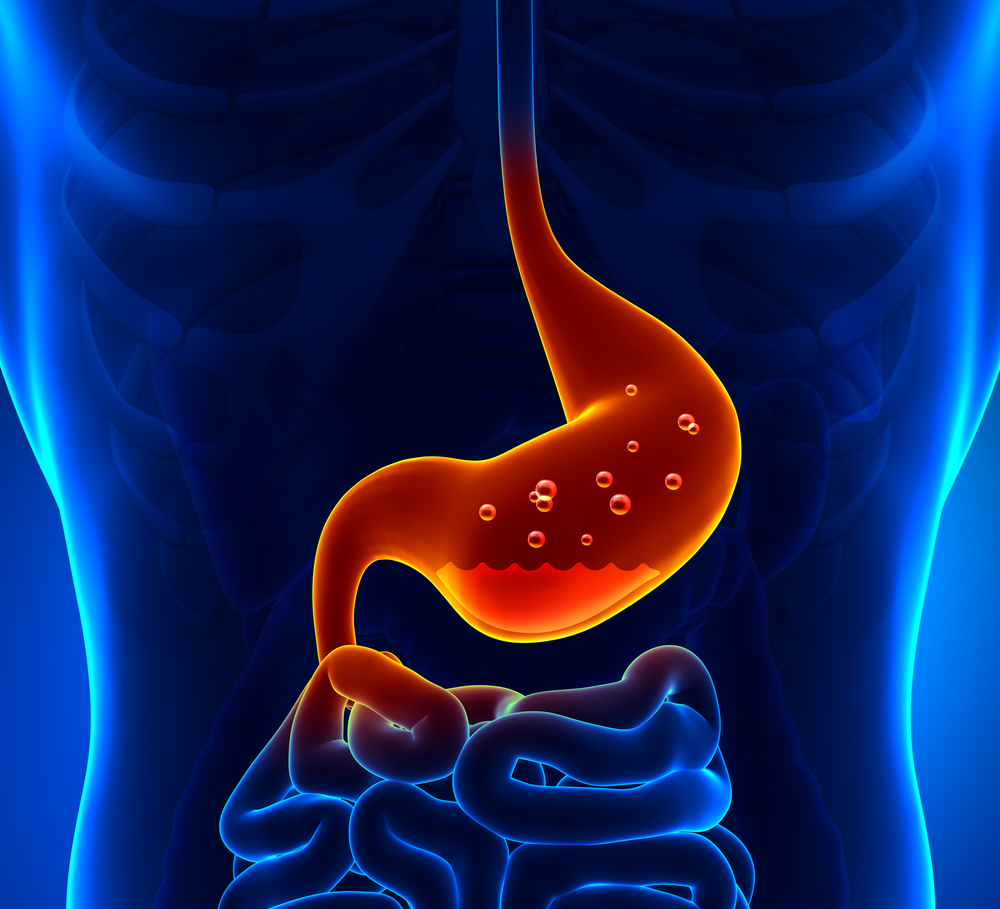 Reflux gastriques : les secrets d’une digestion anti-reflux et ballonnement !