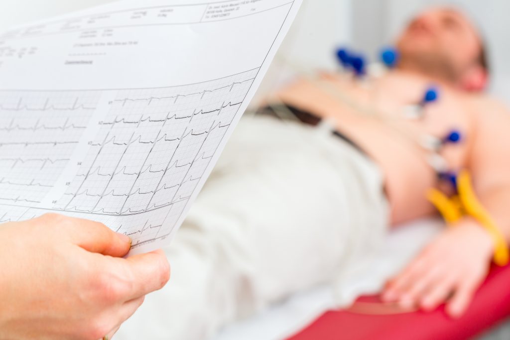 Apprenez A Dire Non A Votre Cardiologue Sante Corps Esprit