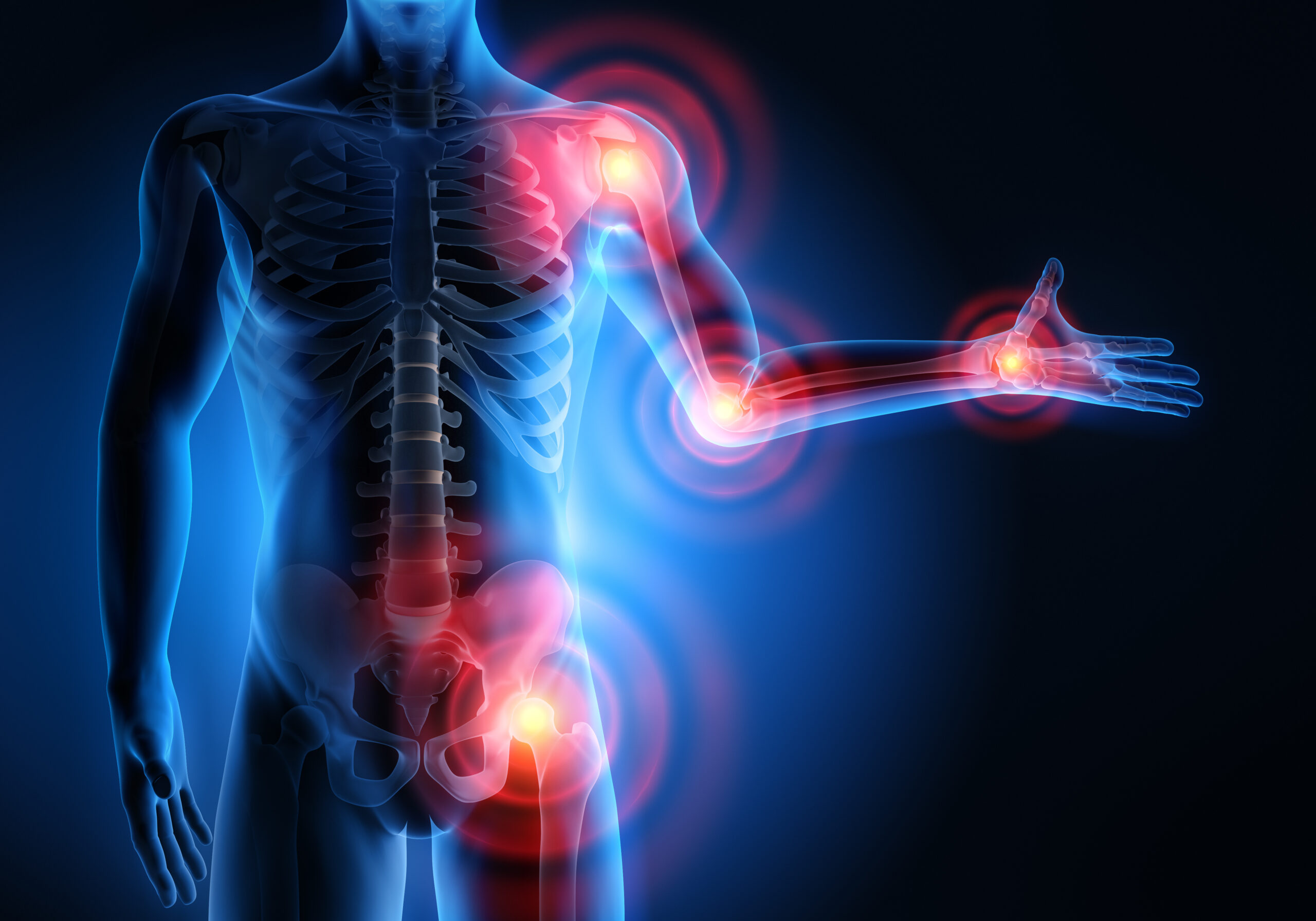 Acupression : ces points à la rescousse de vos douleurs articulaires !