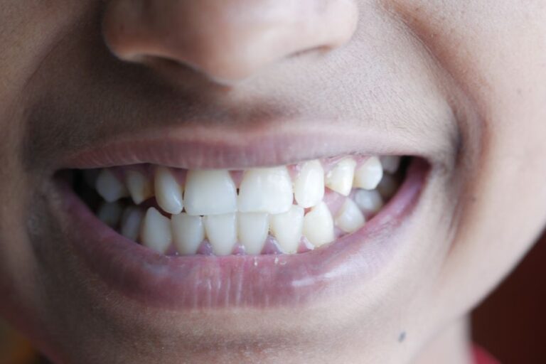 Bouche et dents : arrêtez le massacre et adoptez la méthode STAR